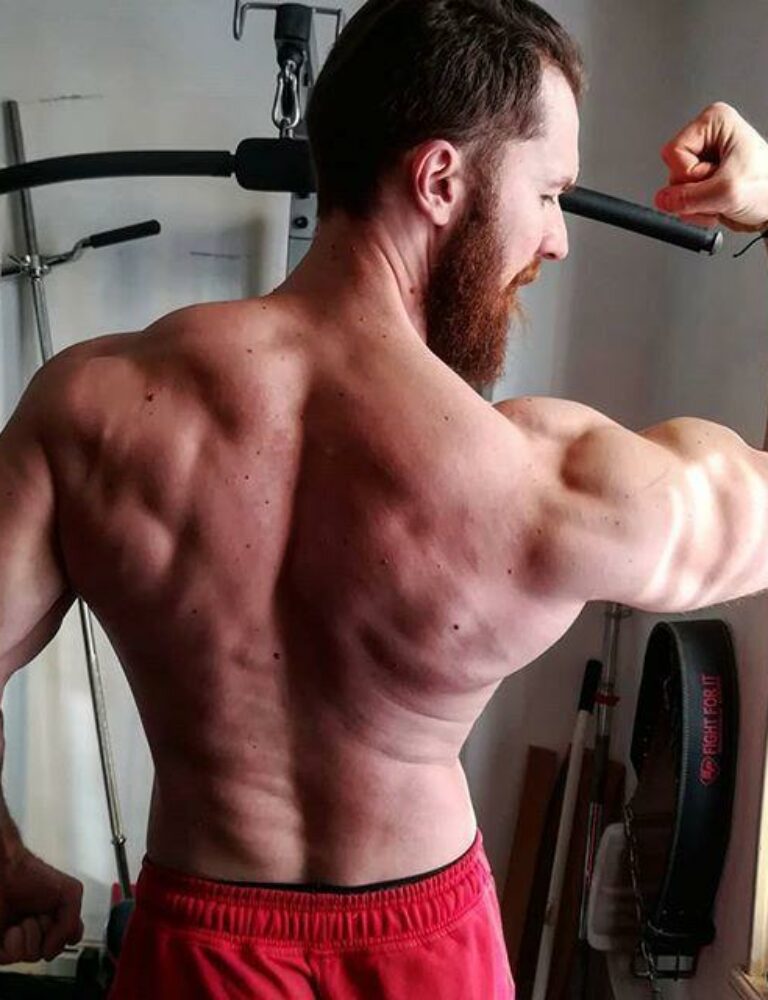 Comment éviter les blessures en musculation ? 20 blessures en musculation